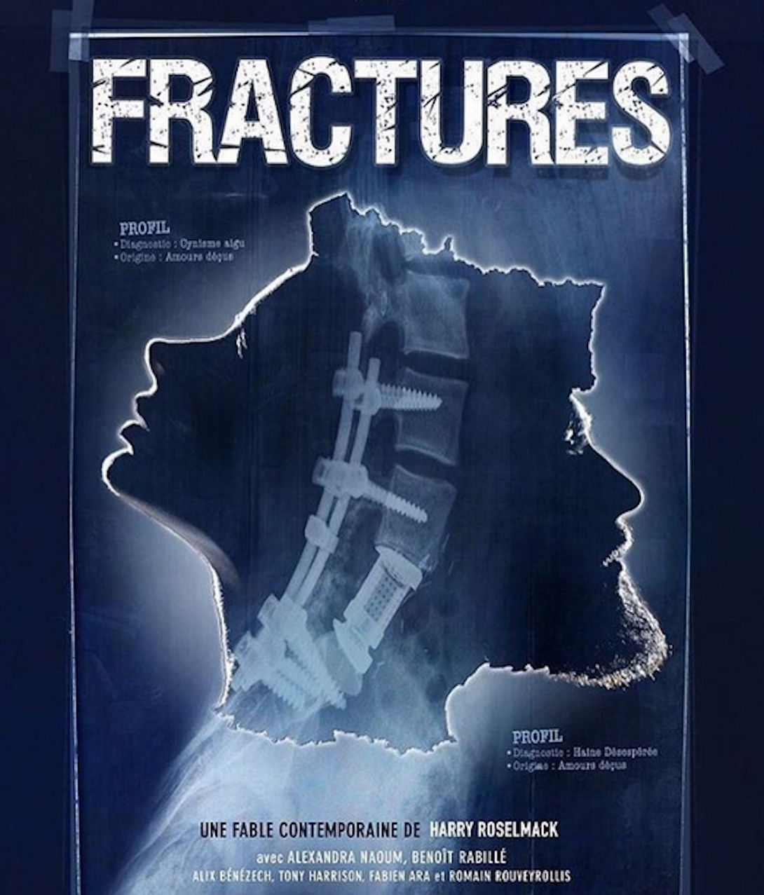 Fractures (2017)